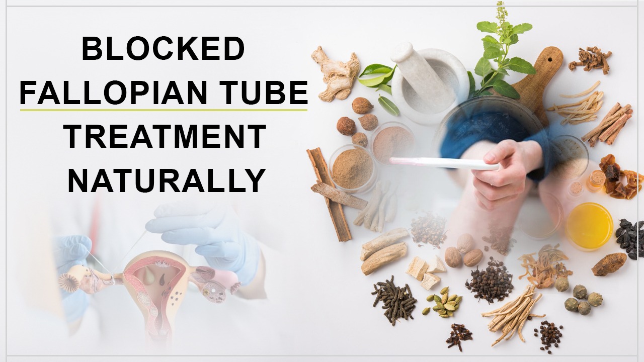 NATURAL TREATMENT FOR BLOCKED FALLOPIAN TUBES