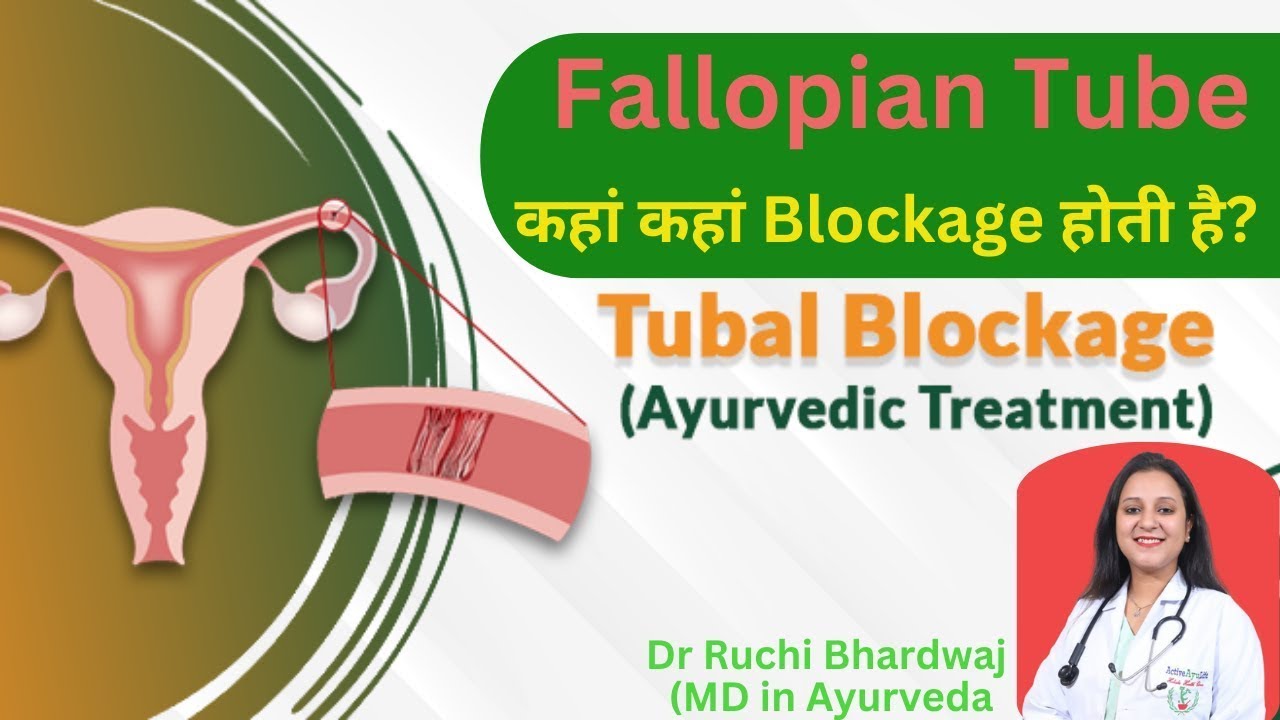 The Fallopian tube get blocked - Dr. Ruchi Bhardwaj
