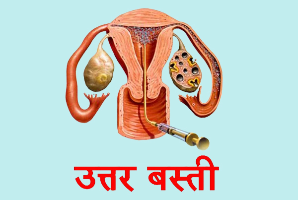 uttarbasti treatment